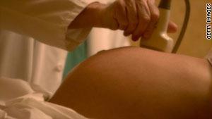  التنويم المغناطيسي  يقلل آلام الولادة