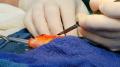 بريطانيا : إجراء عملية جراحية لسمكة زينة 