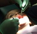 تقنية جديدة لعلاج تسوس الأسنان بدون آلات حفر