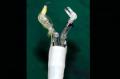 أختراع رجل آلي مزود بأدوات جراحية لإزالة سرطان المعدة